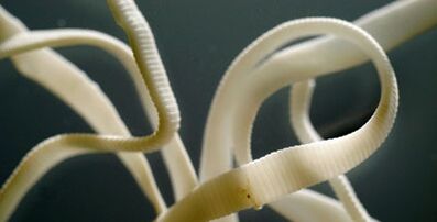 плосък паразит от човешкото тяло